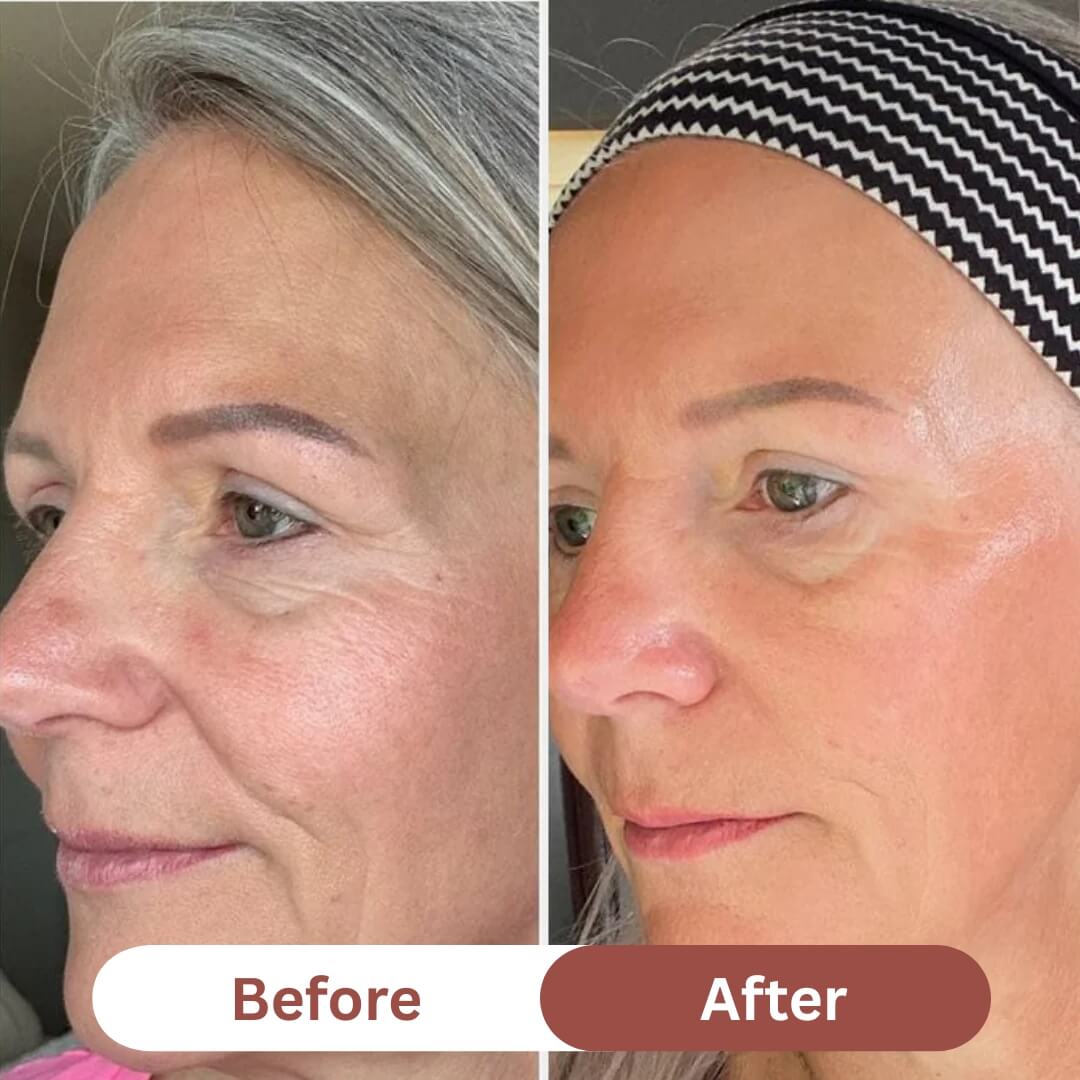 Noirwild™ Collagen Mask