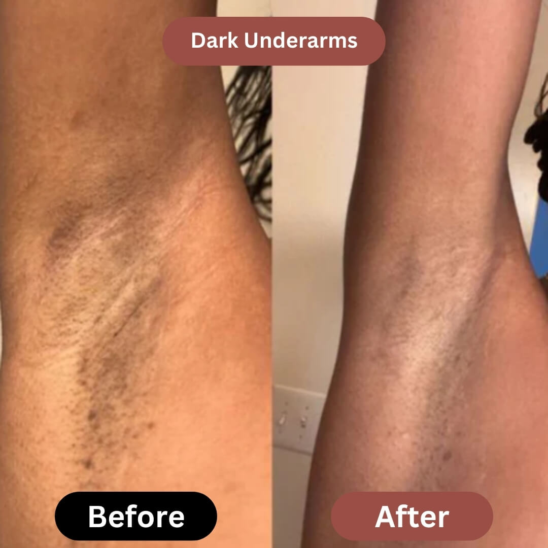 Noirwild™ Turmeric Soap